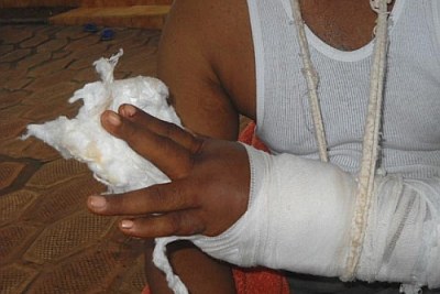 A victim of the 2009 repression (file photo).