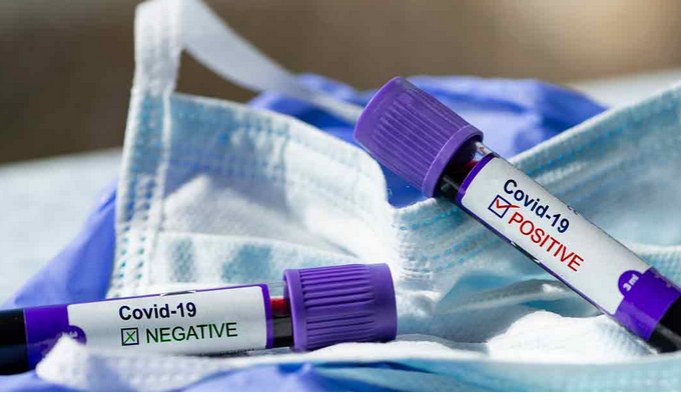 Nigeria: Government investigates allegations of UK mutant coronavirus detection in Nigeria – PTF