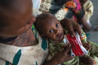 Un garçon âgé d'un an est soigné pour malnutrition dans un centre de santé dans la région du Tigré, en Ethiopie.